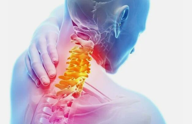 Osteochondroza obszaru szyjki macicy