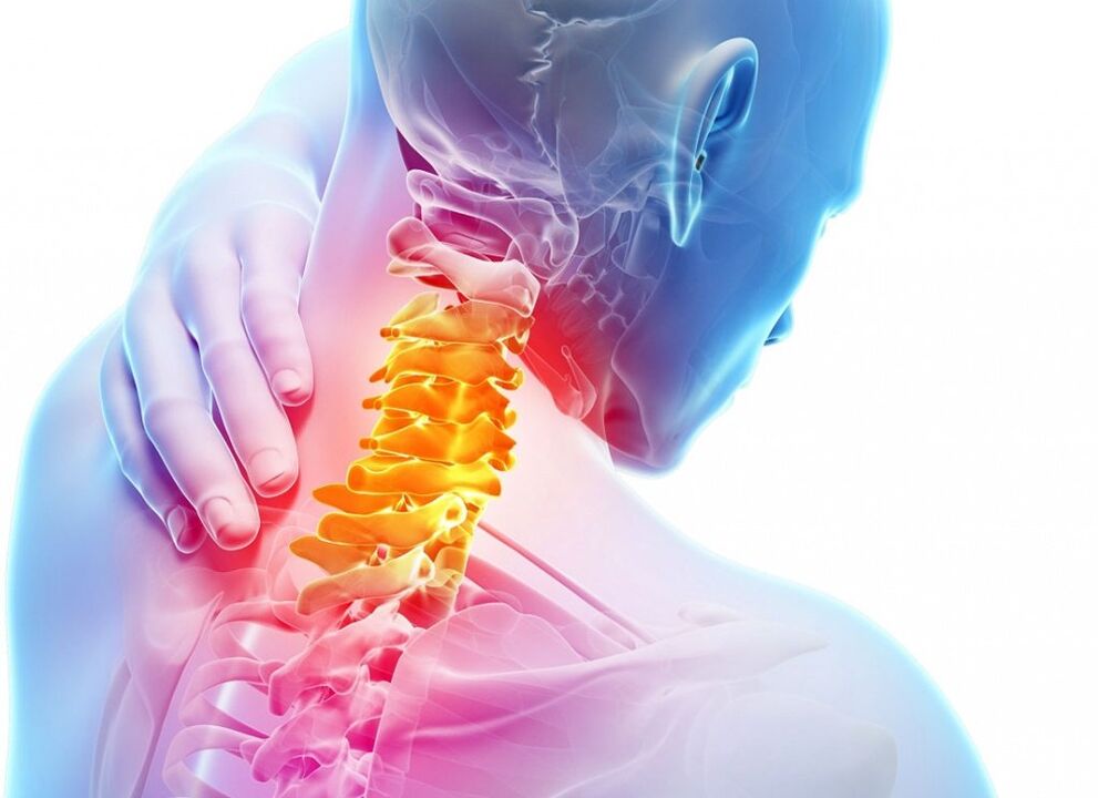 Co to jest osteochondroza szyjna