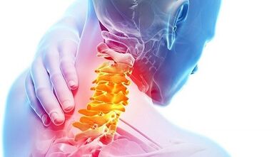Przyczyny osteochondrozy szyjnej