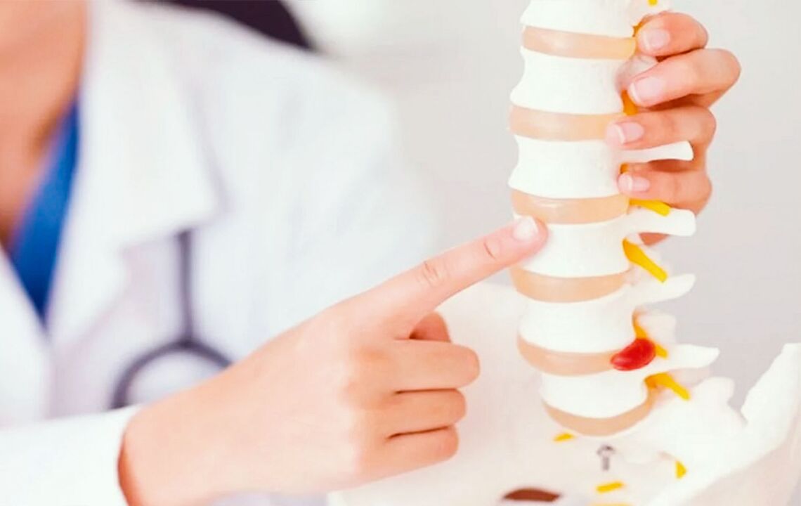 uszkodzenie kręgosłupa z powodu osteochondrozy szyjnej